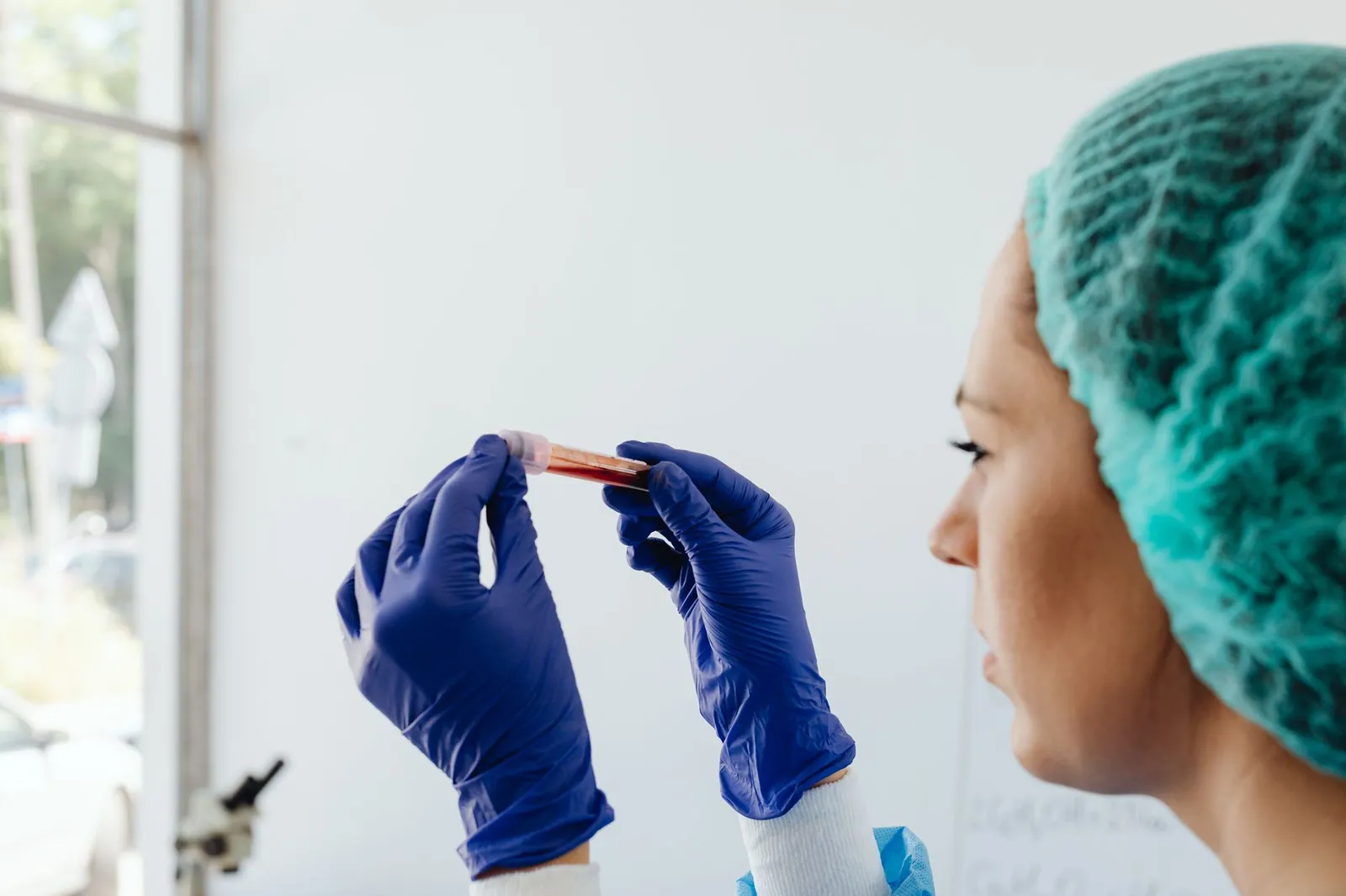 A focused lab technician holds a blood sample in a test tube, wearing gloves and a hair net. Stock photo illustrating Vijaya Diagnostic Centre's earning call story.