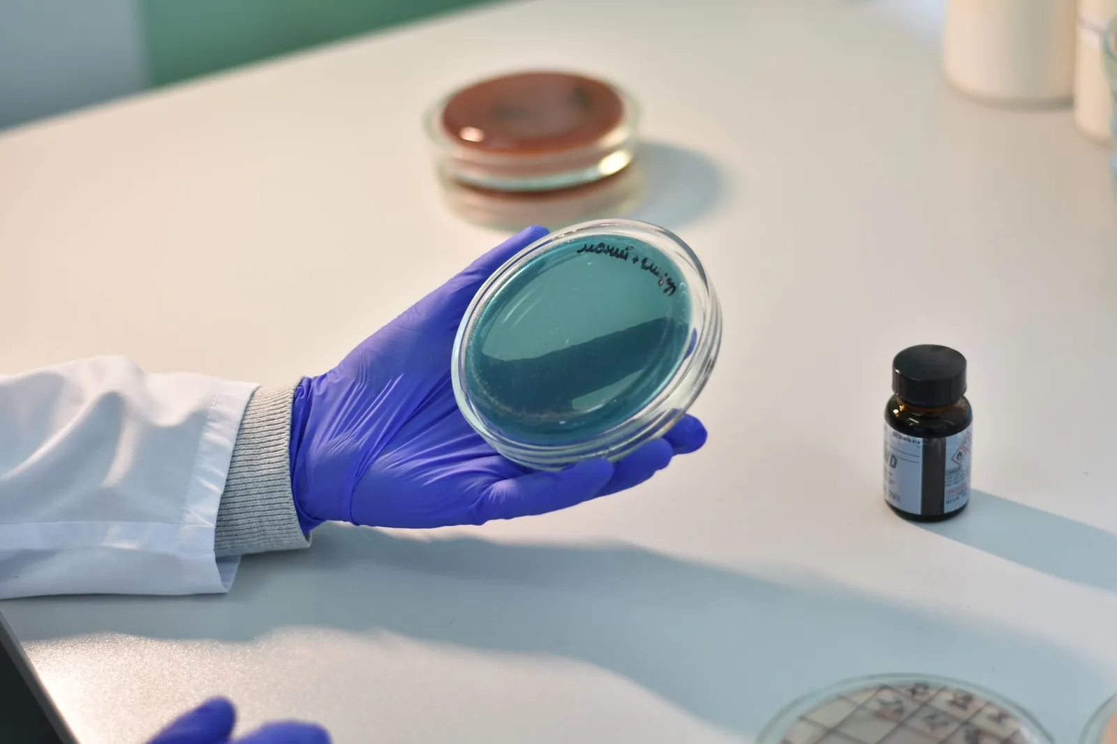 Scientist examines petri dish samples in a laboratory for research purposes. Stock photo illustrating Senores Pharmaceuticals' earning call story.