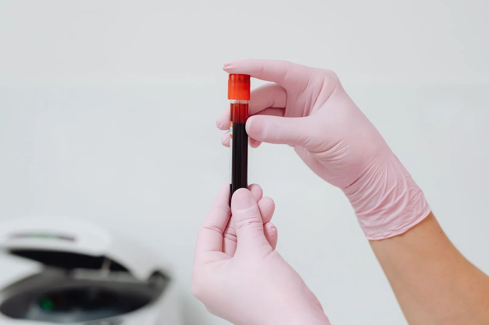 Close-up of gloved hands holding a blood sample in a test tube, ideal for medical and lab contexts. Stock photo illustrating Zydus Lifesciences' product launched story.