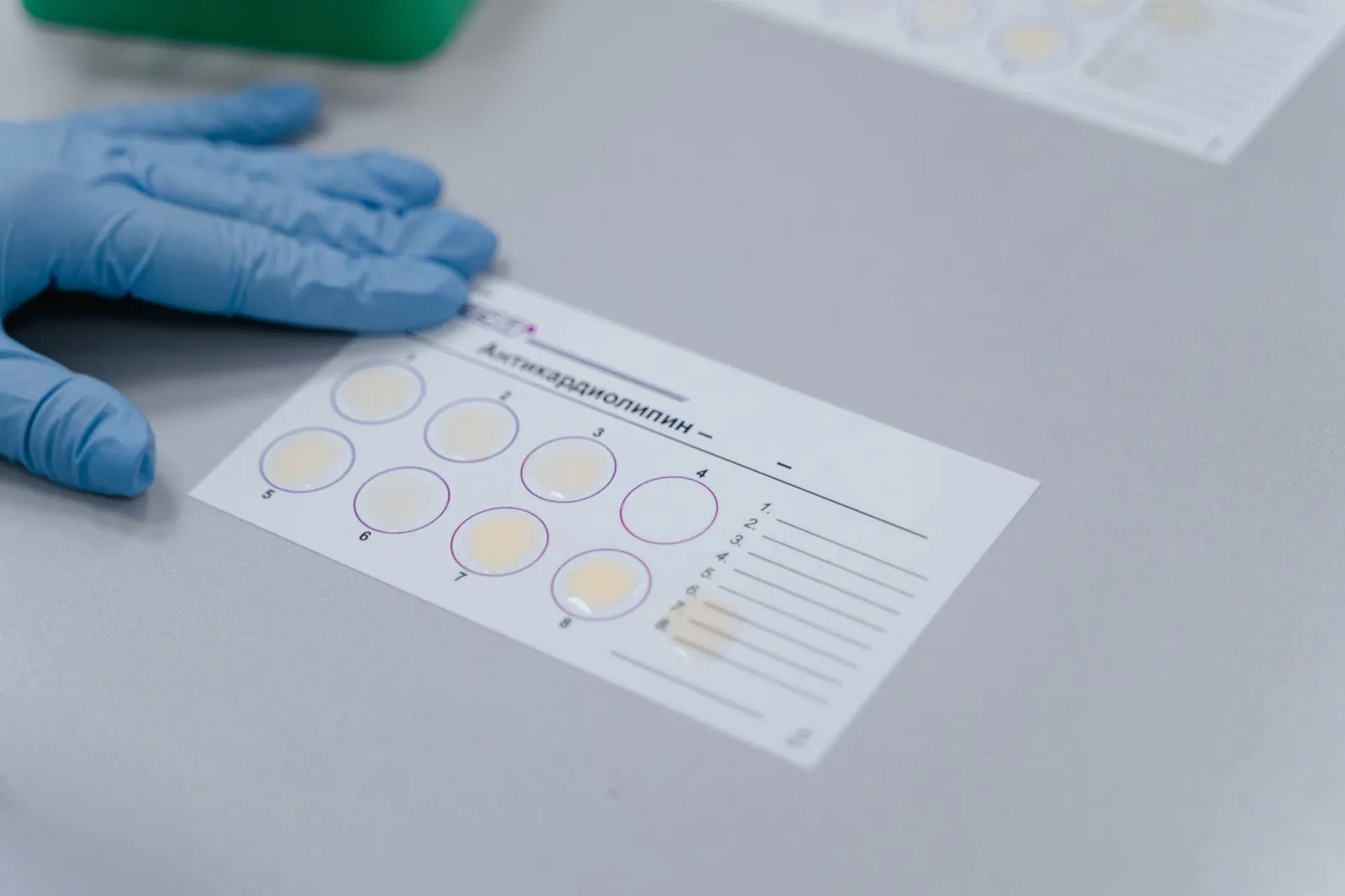 Lab test result form with gloved hand, indicating a scientific experiment setup. Stock photo for the ALFA News guide: Exceptional Items in Results: A SEBI Guide for Indian Investors.