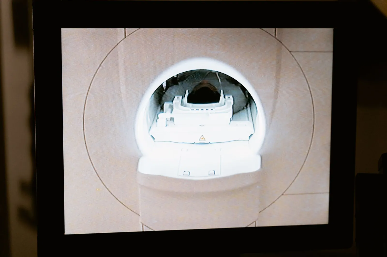Close-up of an MRI scanner displayed on a monitor in a medical clinic. Stock photo illustrating Highness Microelectronics' new order story.